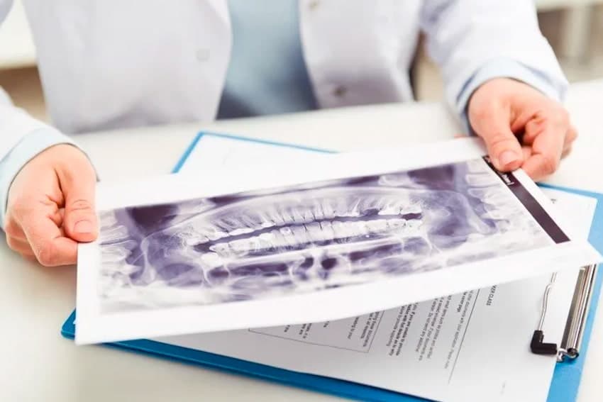 Dentist looking at an x-ray of teeth