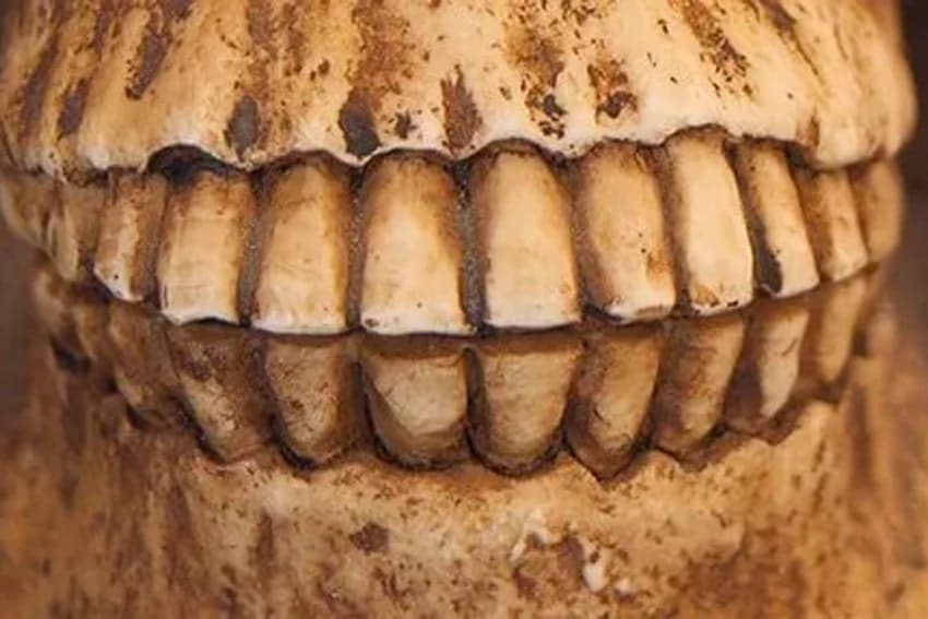 A human skull showing large teeth